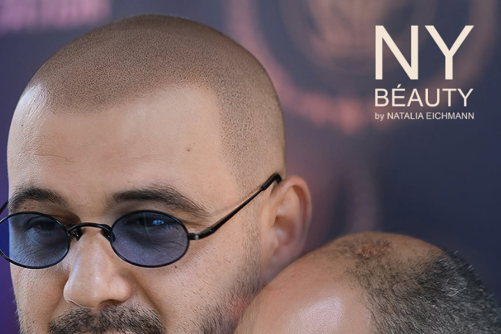 Scalpmicropigmenation SMP Scalpmicropigmenation